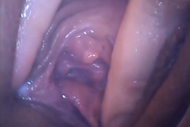 Cosa succede all'interno della vagina durante il sesso e l'orgasmo